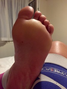 Dealing with a blister